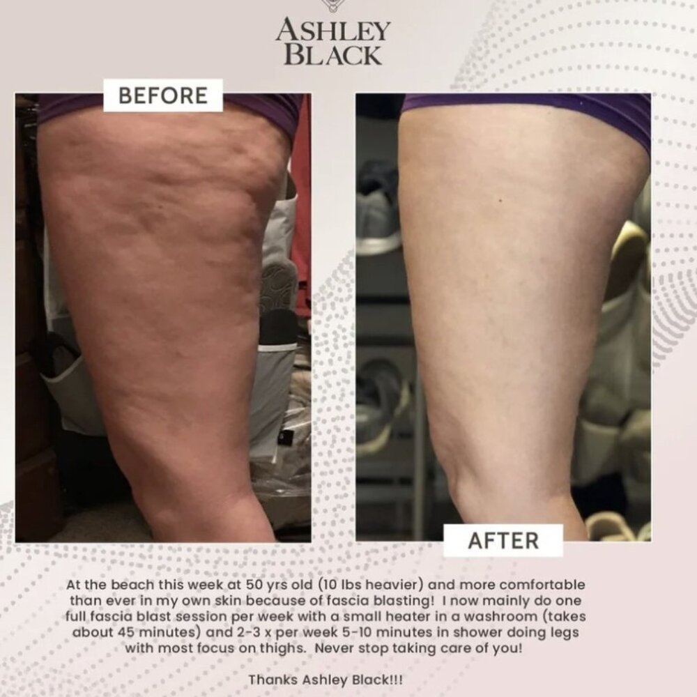 Ashley Black #1 Bestselling FasciaBlaster Tool and Mini 2